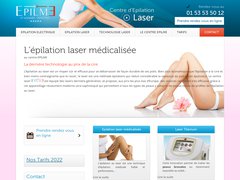 epilation laser